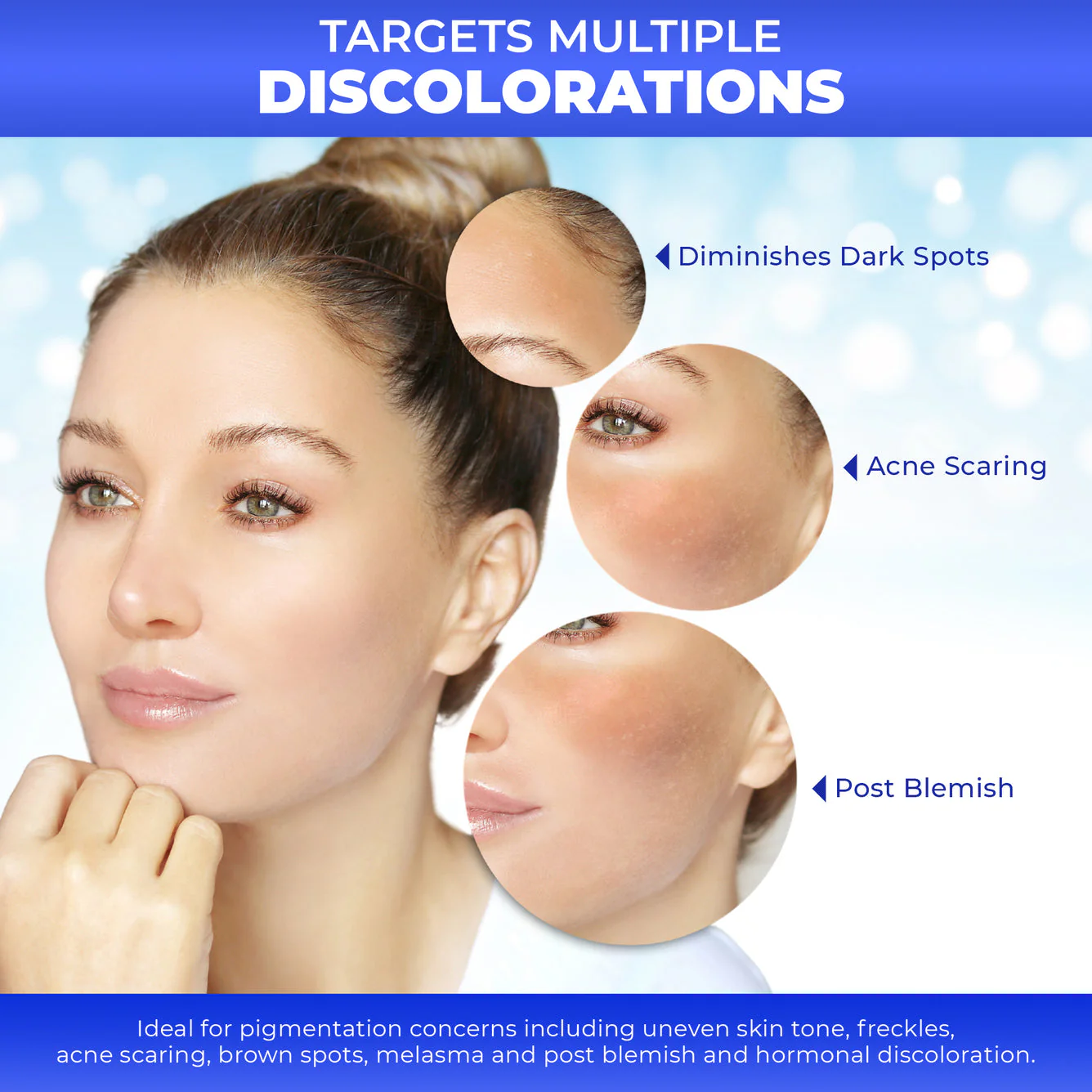 Fair and White Original Dark Spot Remover 30 ml / 1 fl oz - Image 4